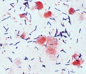 cdiff