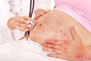 Biểu hiện lâm sàng của người bệnh